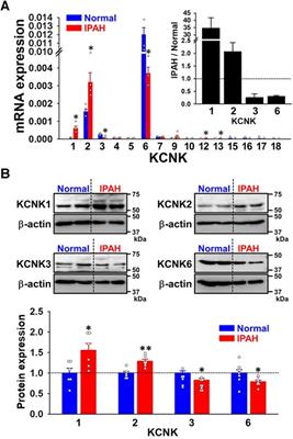 Up-regulated expression of two-pore domain K+ channels, KCNK1 and KCNK2, is involved in the proliferation and migration of pulmonary arterial smooth muscle cells in pulmonary arterial hypertension